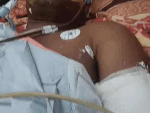 पीजीआई में दाखिल घायल सुरेश।