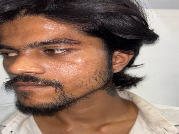 युवक के दोनों आईब्रो कटे, गर्दन पर भी चोट आई