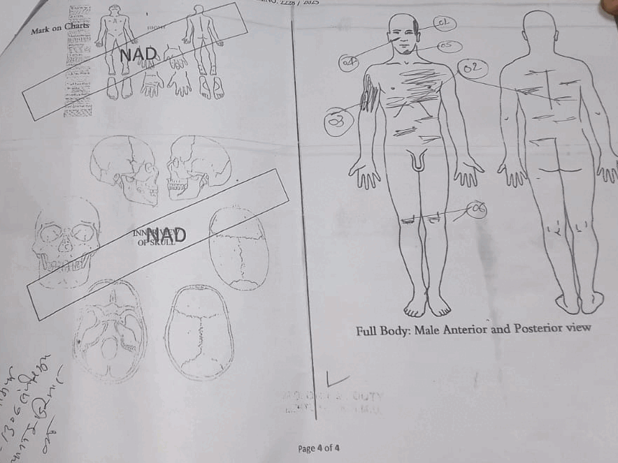 पोस्टमॉर्टम रिपोर्ट में छह गंभीर चोट की पुष्टि हुई है।