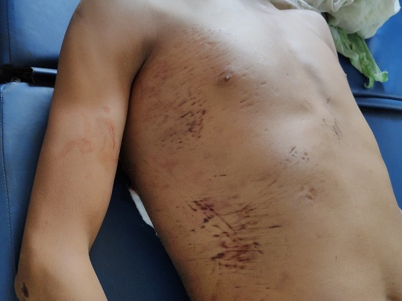 युवक के शरीर पर चोट के कई निशान