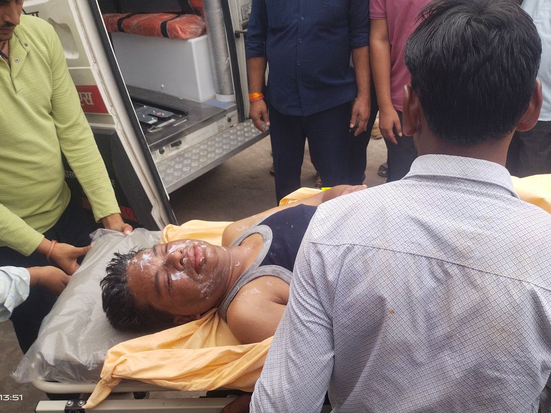 एडीएम नमामि गंगे राजेश श्रीवास्तव के चेहरे से डॉक्टरों ने करीब 500 डंक निकाले हैं।