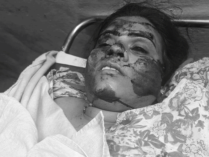 छत्तीसगढ़ के बालोद में इंजीनियर पति ने टीचर पत्नी को बोलेरो से कुचलकर मार डाला। पुलिस ने आरोपी को पकड़ लिया है। - Dainik Bhaskar