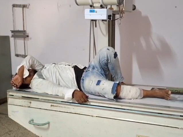 घायल आरोपी को अस्पताल पहुंचाया गया।