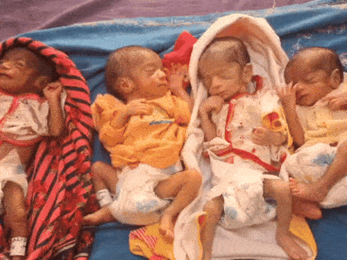 Sirsa Woman Birth Four Children Rajjo Devi Two Boys Girls Husband Sonu Titu Kheda Village Sirsa | हरियाणा में महिला ने एकसाथ 4 बच्चों को जन्म दिया: दो लड़के-दो लड़कियां, प्रेग्नेंसी के