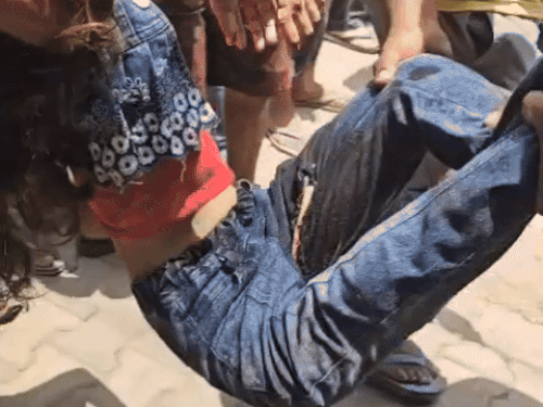 घायल हसीना को अस्पताल लेकर जाते लोग। - Dainik Bhaskar