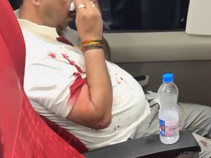 यात्री के नाक, मुंह, कान से खून बहने लगा।