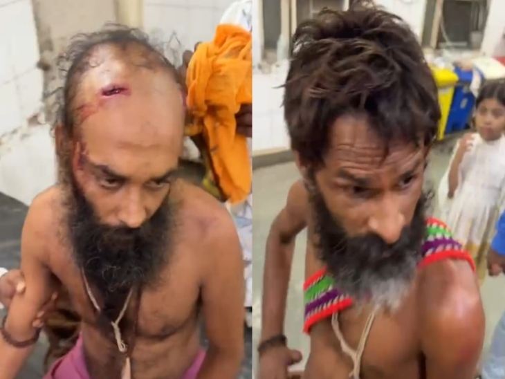 घायल बाबा शिवानंद गिरी और सतीशानंद गिरी महाराज। - Dainik Bhaskar