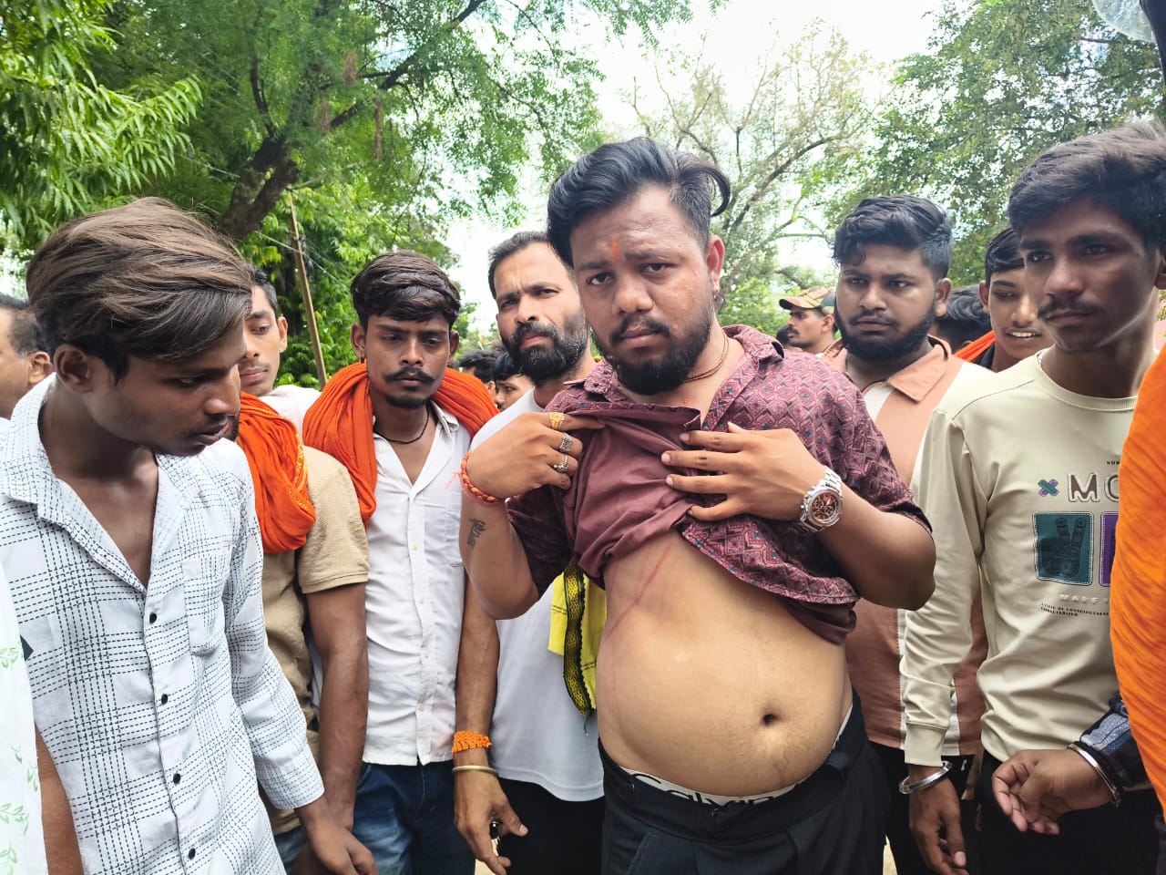 विवाद के दौरान मारपीट के दौरान युवक को लगी चोट।