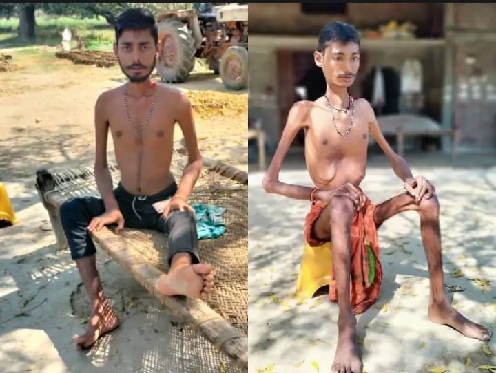 तस्वीर में बाएं से अनीश यादव (25) और दाएं मनीष यादव (23)।