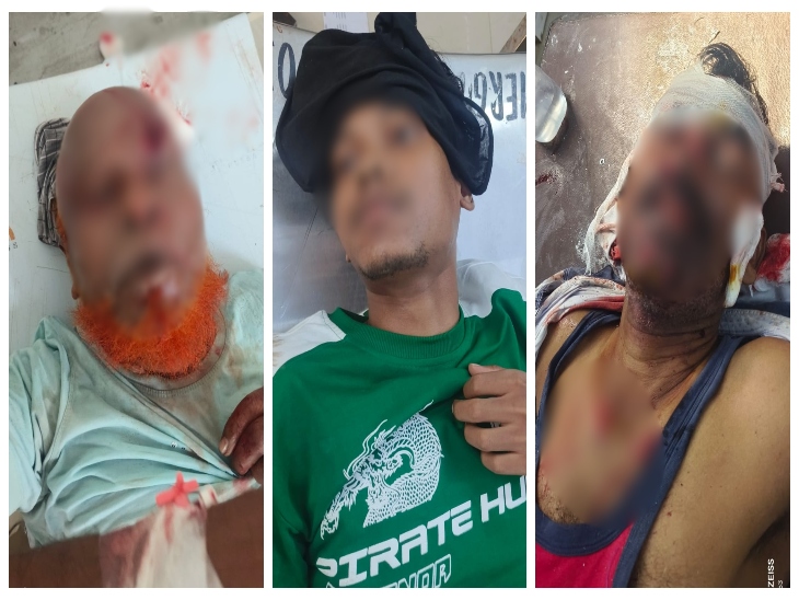 मृतक- मोहम्मद इसराइल और लाल साहनी शामिल है।