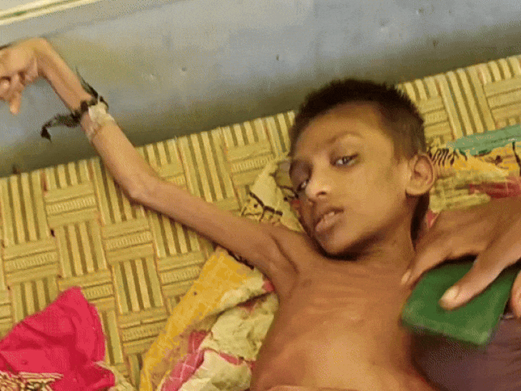 डिस्टोनिया एक न्यूरोलॉजिकल मूवमेंट डिसऑर्डर है, इससे मांसपेशियों में खिंचाव होता है।