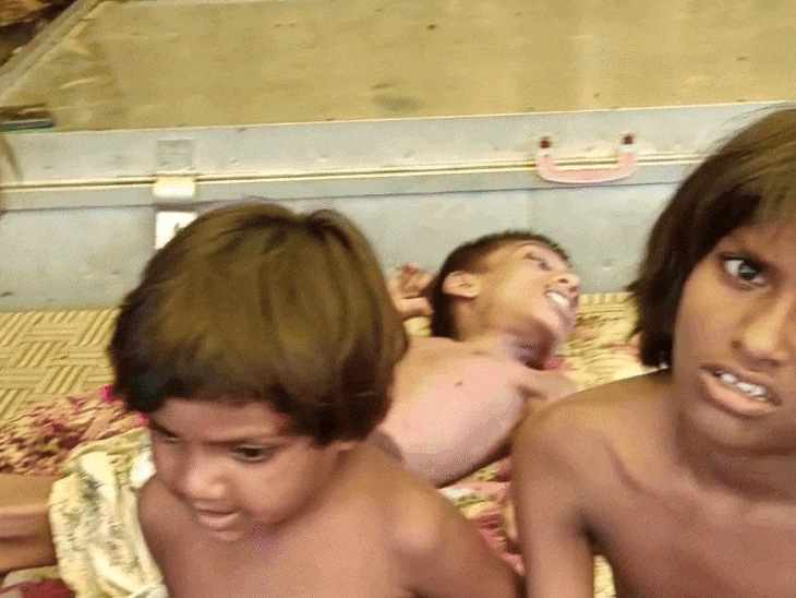 कॉपर डिस्टोनिया को विल्सन रोग भी कहा जाता है। यह दुर्लभ आनुवंशिक बीमारी है।