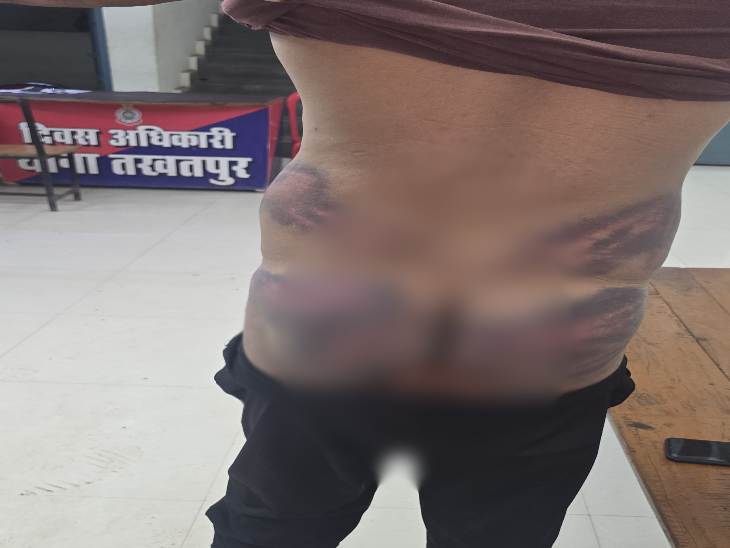 पिटाई करने से कंडक्टर को गंभीर चोटें आई है।