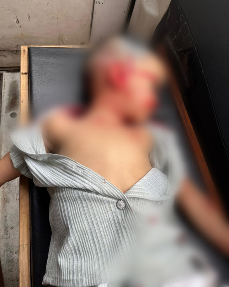 पेड़ गिरने से तीन साल की बच्ची निदा की मौत हो गई।जबकि दंपती का इलाज चल रहा है।