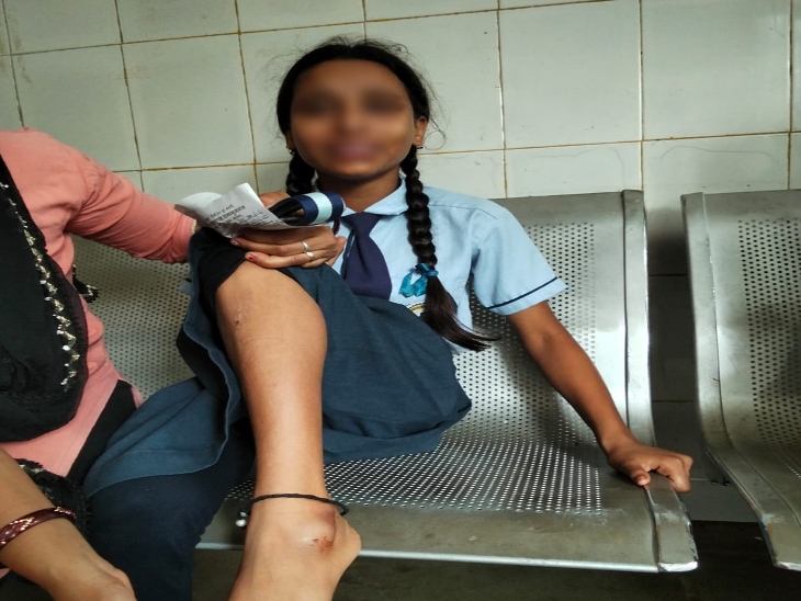 स्कूल जा रही बच्ची के पैर में कुत्ते ने काटा।