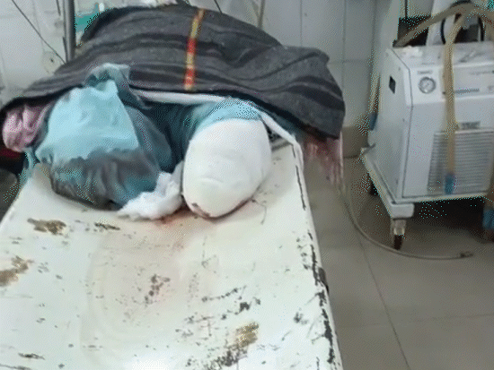 देवेंद्र की सोमवार इलाज के दौरान मौत हो गई।