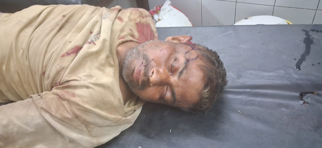 घायल को इलाज के लिए लेकर अस्पताल गए