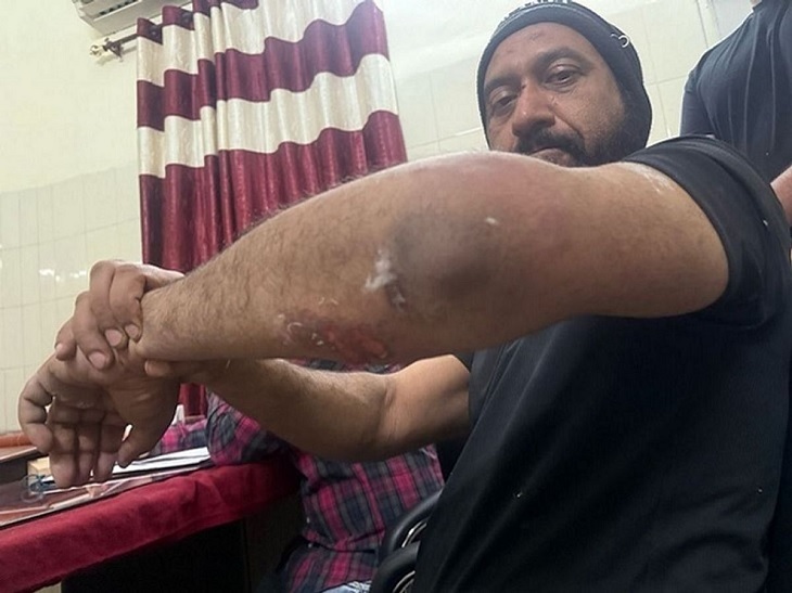 कर्नल बाठ घटना के बाद । फाइल फोटो