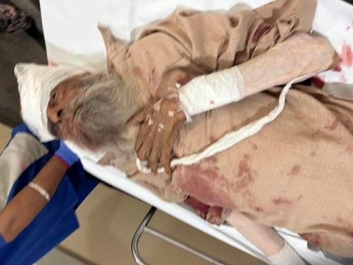 Fauja Singh was taken to a private hospital in Jalandhar in critical condition on 14 July. He died there.