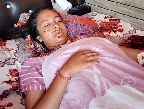 घर पर घायल दीपाली केवल जूस और पानी पी रही।
