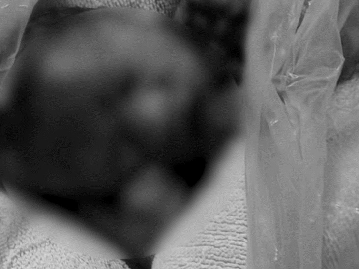 Stray dogs scratched the child badly. On Sunday, he was cremated by postmortem.