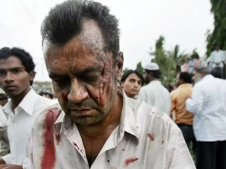 ट्रेन में सवार पैसेंजर ब्लास्ट के बाद घायल हुए। एक शख्स के सिर पर चोट लगी।