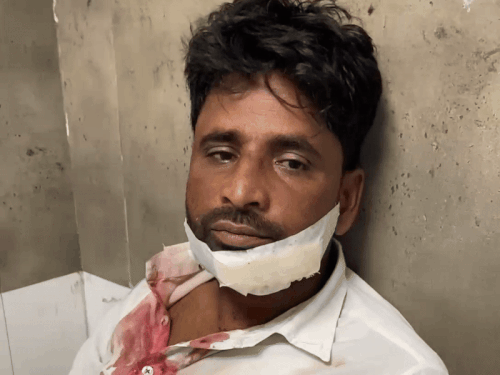 अस्पताल में उपचाराधीन महमूद, जोकि शोर सुनकर घर से बाहर सिर्फ यह देखने आया था कि क्या हो रहा है। इस दौरान उसे भी मुंह पर ईंट लगी।