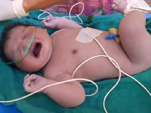 इंदौर में औसत से काफी बड़े और वजनी नवजात ने जन्म लिया।