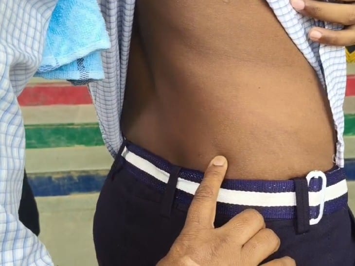 कमर में चोट लगी है।