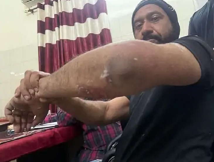 कर्नल पुषपिंदर बाठ अपनी चोट दिखाते हुए । (फाइल फोटो)