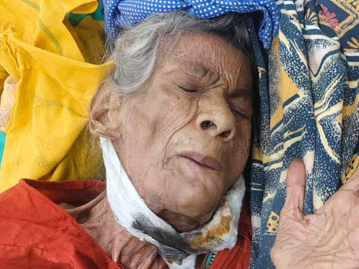 बुजर्ग महिला इस हालत में पुलिस को मिली। पुलिस ने ही उसे अस्पताल में भर्ती कराया।