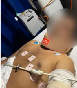 सौरभ को अभी सीरियस मेडिकल निगरानी में रखा गया है।