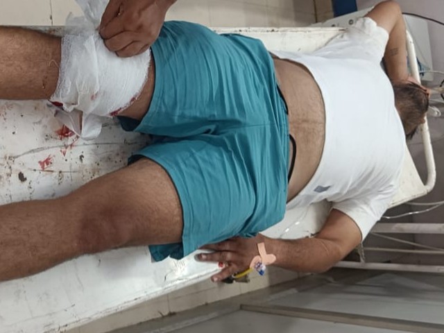 Police encounter with a criminal in Jind, accused shot in the leg, admitted to hospital
