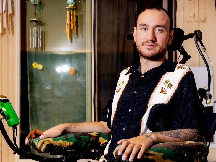 For the first time, the neuralic chip was applied to the mind of a man named Nolland Arbo in January 2024. In 2016, after an accident, the lower part of his neck was paralyzed.