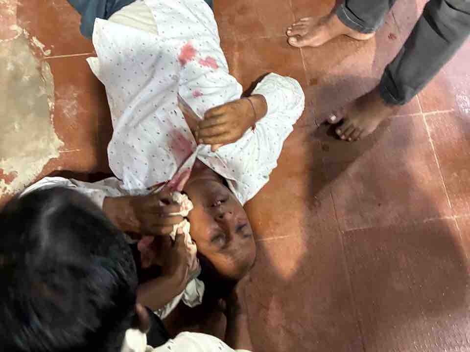 सिर में चोट लगने से श्रद्धालु ओम कुशवाहा को जोधपुर रेफर किया गया है।
