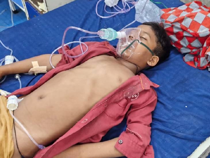 सांप के डसने के बाद दस साल के आशिक की हालत में पहले से सुधार हुआ है।