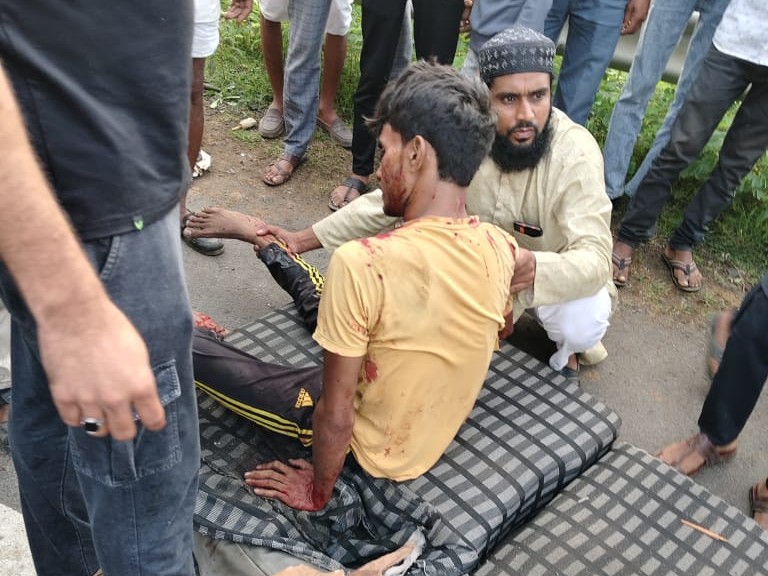 हादसे में युवक घायल हुआ।