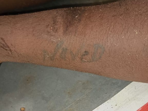 मृतक के हाथ पर कुछ लिखा मिला है।