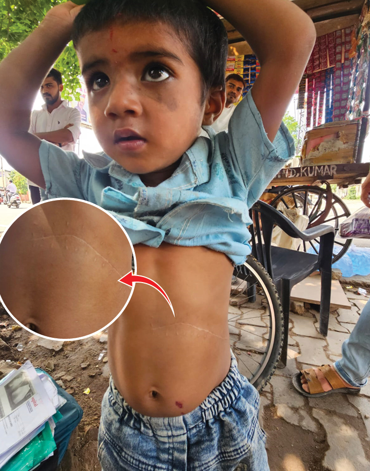 ये मयंक है। जिसकी किडनी निकाली गई है। परिवार भरतपुर आया तो पूरी कहानी बताई।