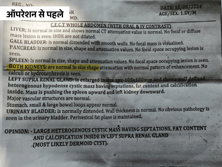 ये रिपोर्ट मयंक की है। पिता ने बताया ये रिपोर्ट ऑपरेशन से पहले की है। इसमें साफ लिखा है कि दोनों किडनियां नॉर्मल है।