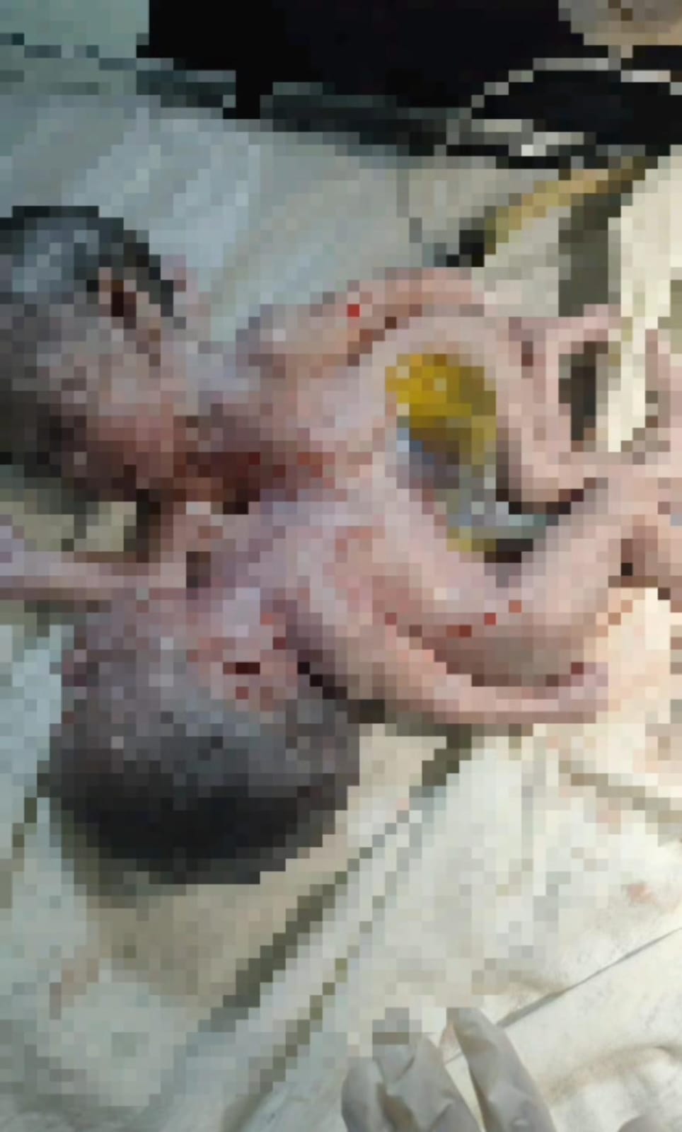 मेडिकल में जन्मे जुड़वा बच्चे