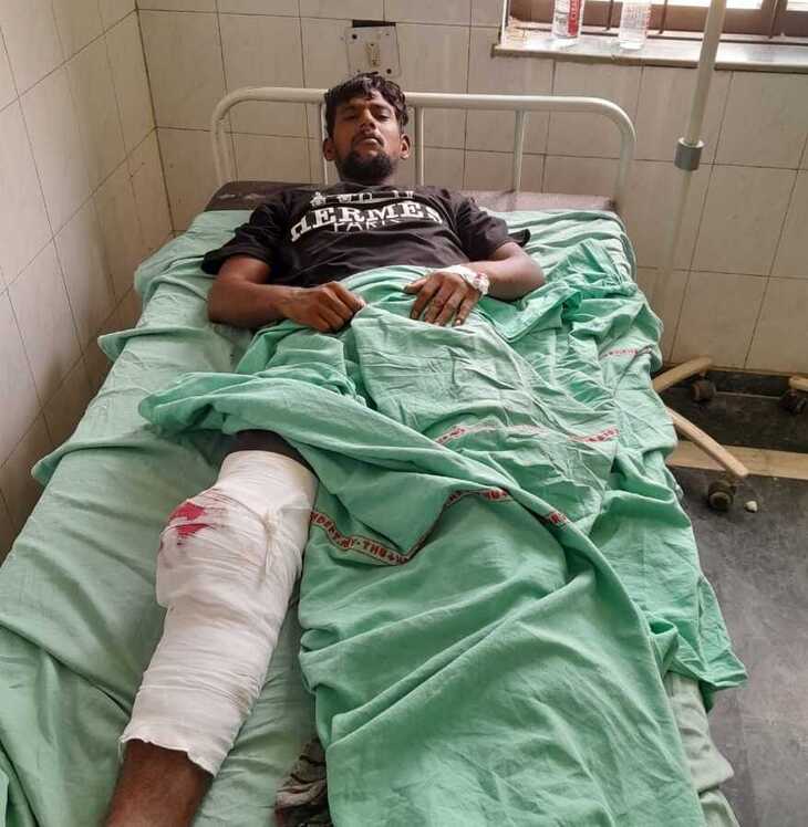 पुलिस एनकाउंटर में बदमाश रमनदीप उर्फ पेट्रोल को पैर में लगी गोली।