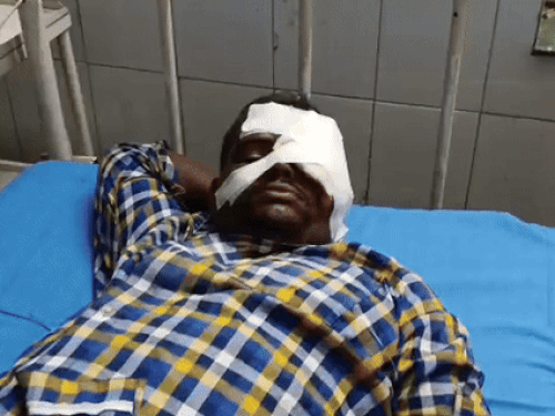 युवक की आंख के पास 10 टांके आए हैं, जो अलवर जिला अस्पताल में भर्ती है।