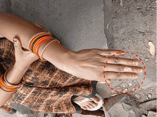 युवक की बहन ने बताया कि हाईटेंशन लाइन से मेरा भी हाथ झुलस चुका है।