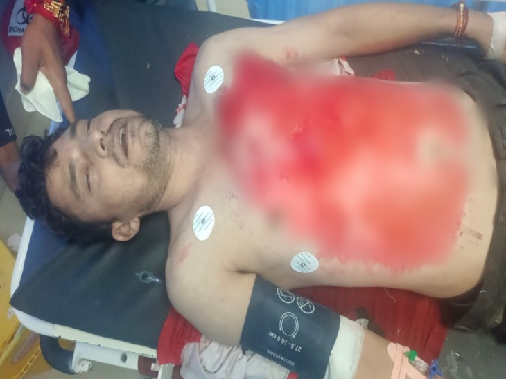 स्थानीय लोगों ने घायल को अस्पताल पहुंचाया।