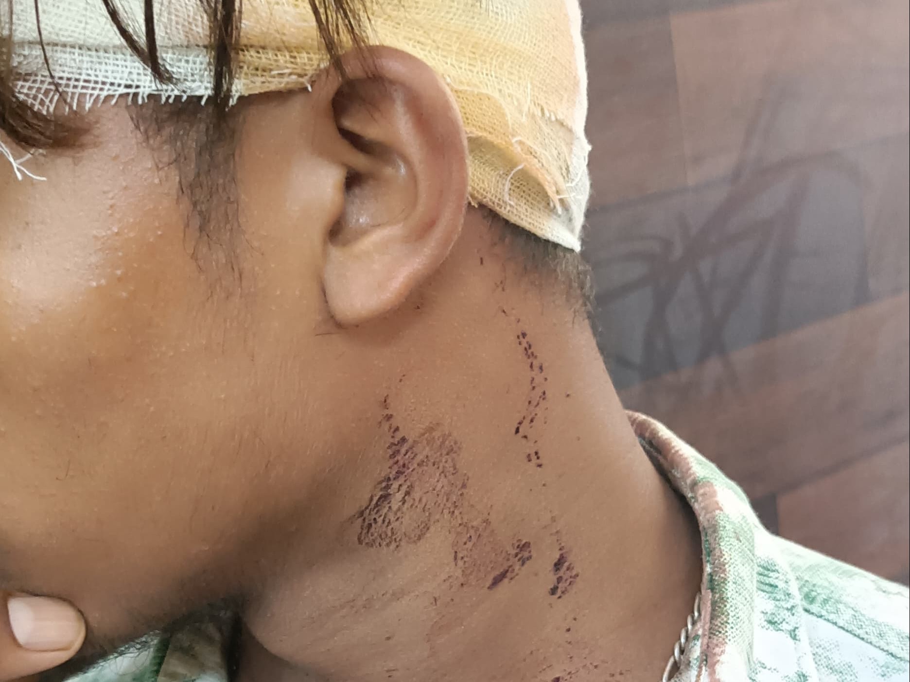 हमले में एक छात्र का सिर फट गया।