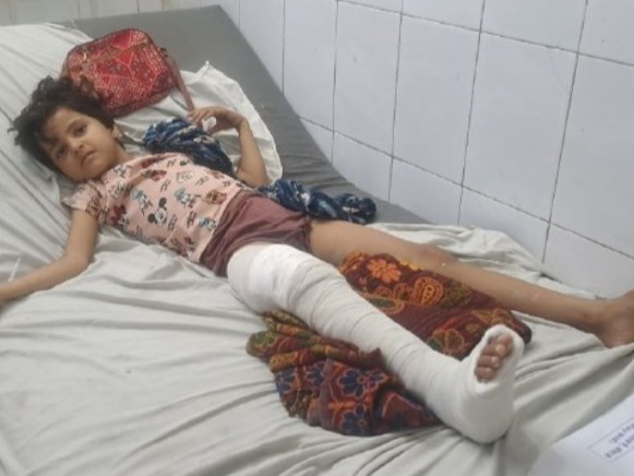 पाली के बांगड़ हॉस्पिटल में सड़क हादसे में घायल बालिका। - Dainik Bhaskar