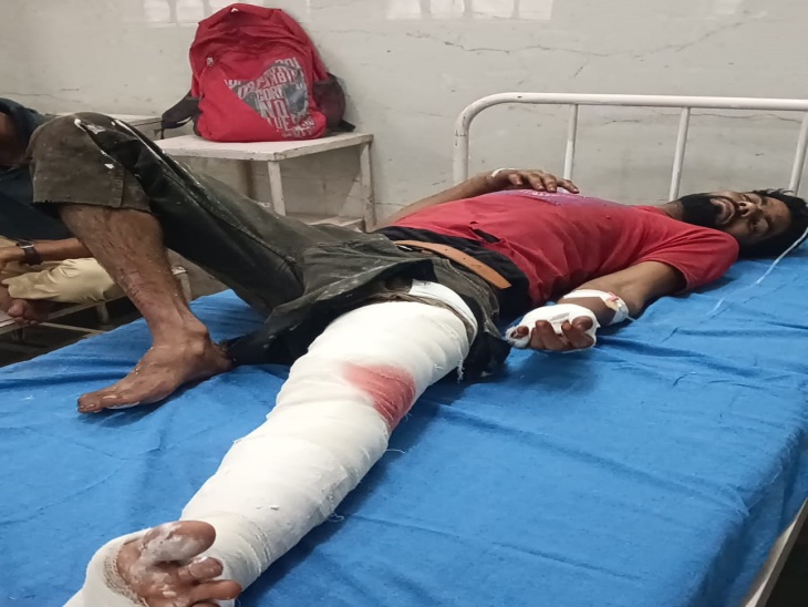 ये जिला अस्पताल में भर्ती गंभीर घायल युवक तारीफ है। जिसका पैर फ्रैक्चर है।