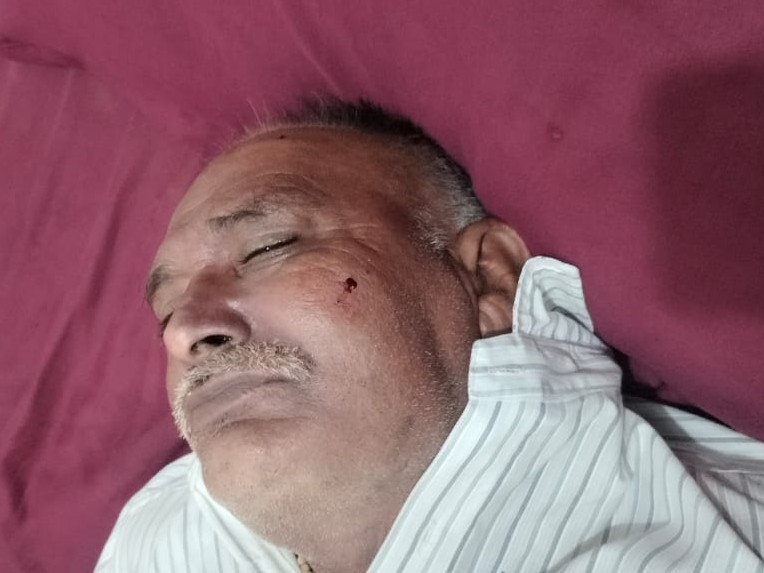 होटल के बाथरूम में मिला शव, सिर पर चोट का निशान; मधुमेह से थे पीड़ित|मथुरा,Mathura - Dainik Bhaskar