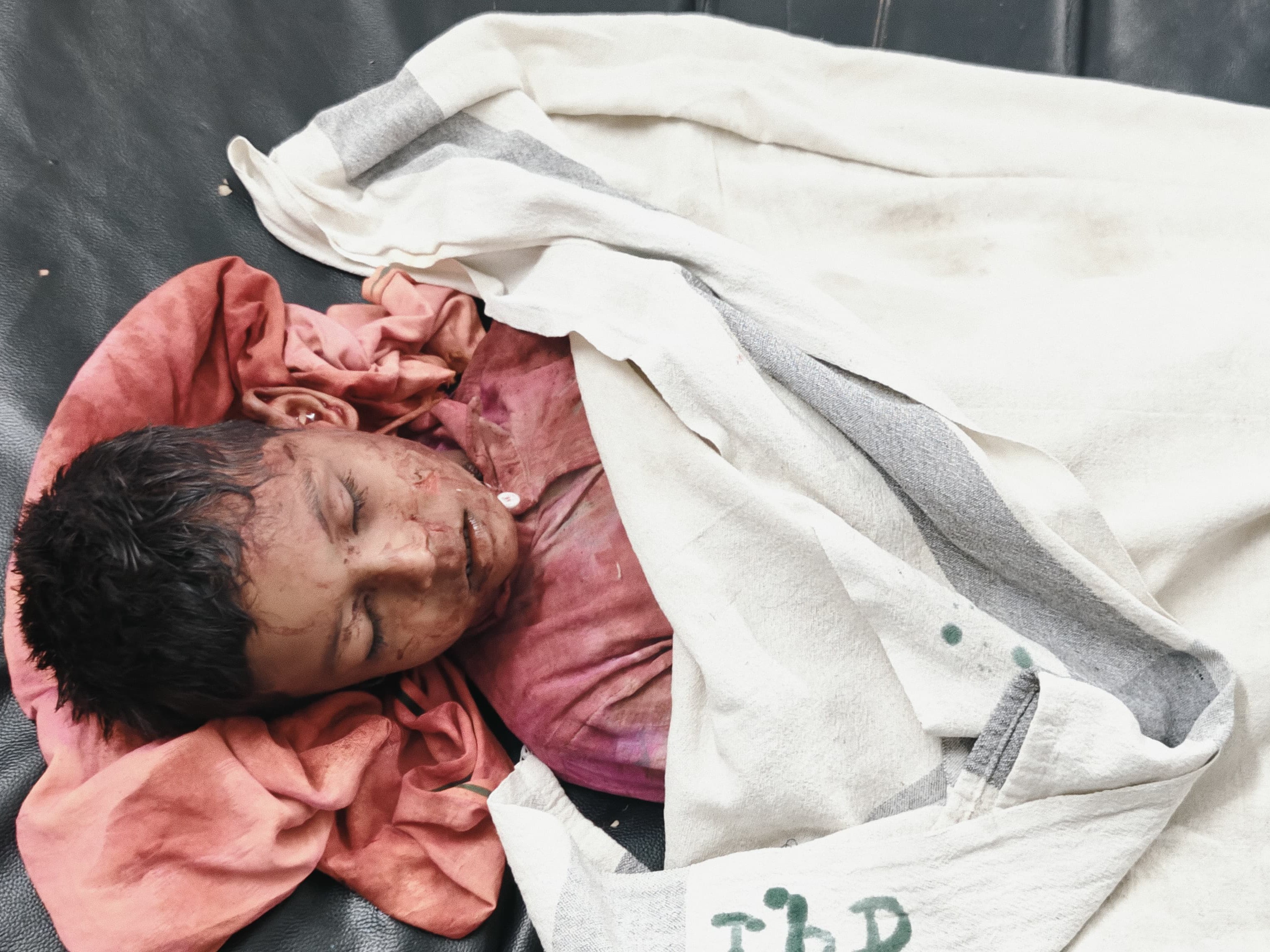 मृतक बच्चे राजकुमार का सोमवार को पोस्टमॉर्टम कराया गया।